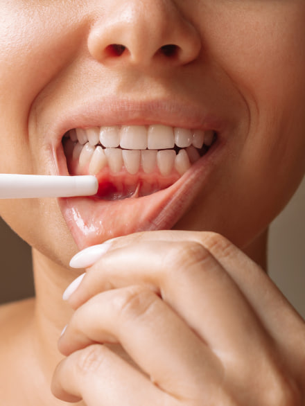 Meet our Smile Expert